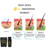 Rodil Minoxidil Hair Grower™