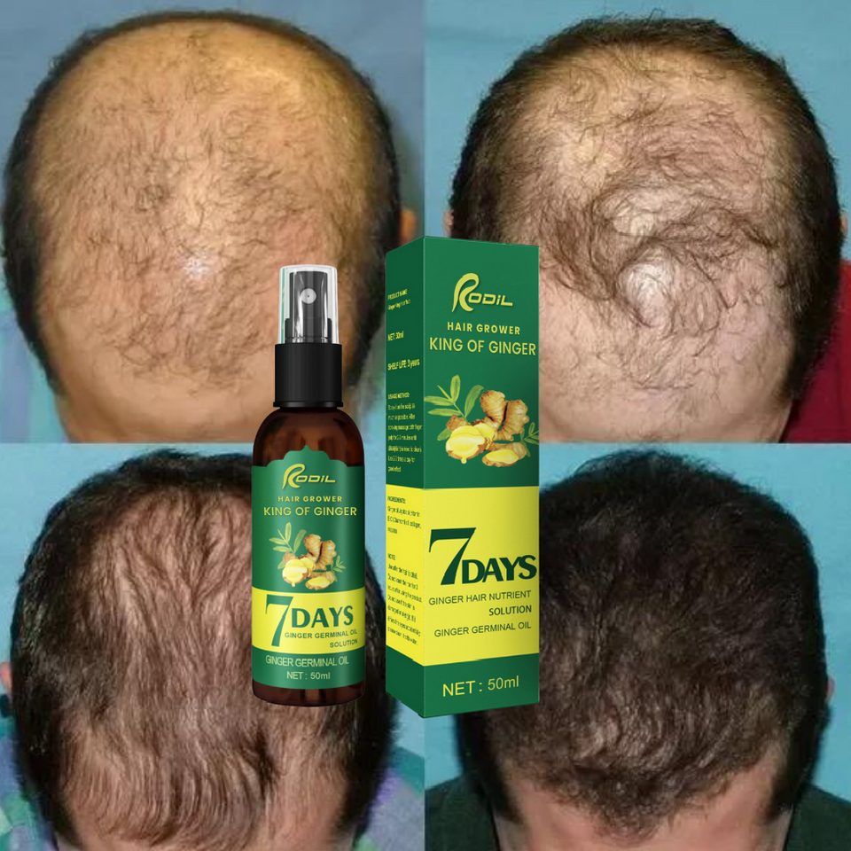 RODIL king of ginger hair nourishing oil 7 days ginger germinal essence hair growth™